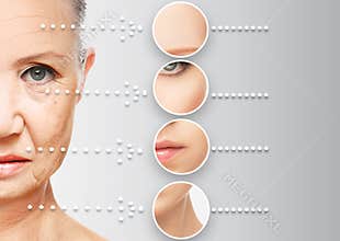 Beauty concept skin aging. anti-aging procedures, rejuvenation, lifting, tightening of facial skin