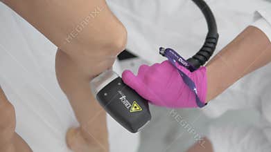 Vertical video, laser hair removal of legs on a modern laser