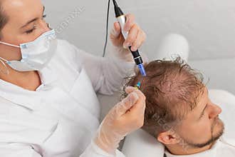 Trichologist doing man improve hair growth procedure, dermapen microneedling, vitamin injections