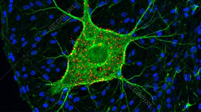 Spinal Cord Motor Neuron Alpha Motoneuron Confocal