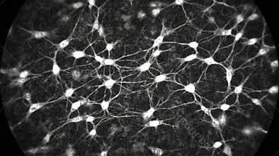 Corneal Stroma Keratocyte Network Confocal Depth