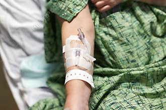 Patient's arm with IV started and hospital wrist band
