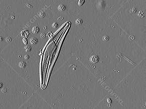 Microscopic Diatom