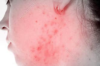 Problems with skin