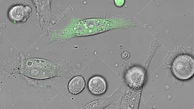 PC-3 human prostate cancer cells in culture.