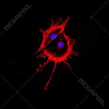Confocal microscopy imaging of two cancer cells touching each ot