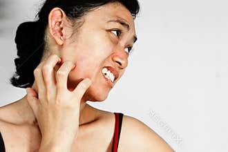 Woman scratch face with skin rash