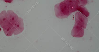 Cells of the oral mucosa with cell nucleus and bacteria