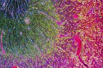Microscopic section of human kidney