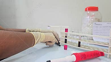 Laboratory Technician Using Micropipette and Test Tubes for Scientific Research, Medical Laboratory Analysis