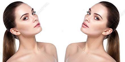 Female face before and after procedure lips augmentation