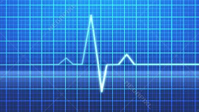 EKG
