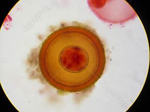 Tapeworm (Taenia) egg