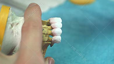Dental technician applying ceramics glaze to a cast made with CNC dental machine