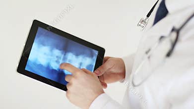 Doctor working with x-ray scan on tablet pc
