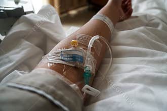 Patient arm with iv tube at hospital
