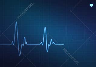 Heartbeat Monitor