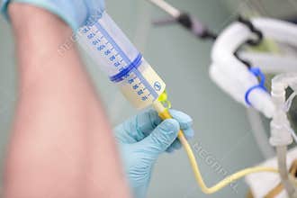 Process of feeding the patient through the tube in critical condition