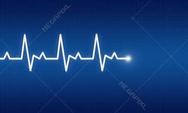 EKG