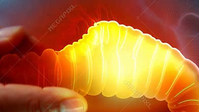 Intestinal sensitivity: visualization of bowel pain emphasizes impact of digestive disorders on daily life, underscoring need for