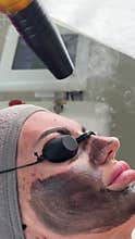 Young woman getting carbon laser facial at beauty clinic. Professional skincare