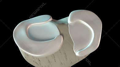 Meniscus tear overview