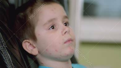 A child suffering from the symptoms of Chickenpox is depicted in a comfortable environment