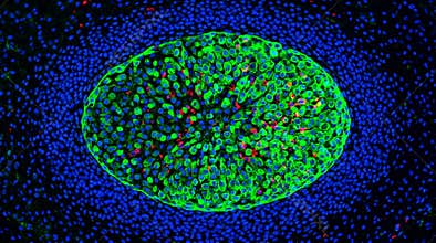Lymph Node Germinal Center B Cell Reaction