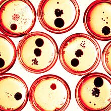Growing Bacteria in Petri Dishes.