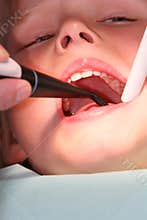 Open wide