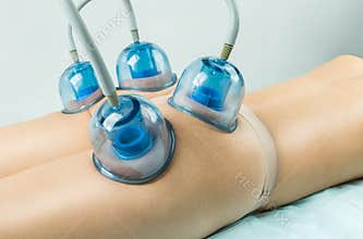 Vacuum body massage.