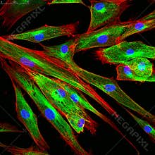 Confocal microscopy of fibroblast cells