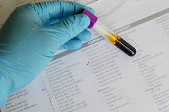 Hepatitis antibody testing