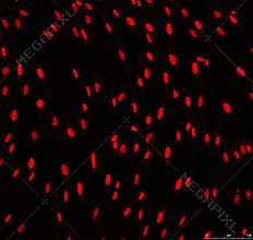 Confocal microscopy of fibroblasts nuclei