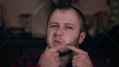 A young guy of European appearance in a plaid shirt closeup presses a pimple. Akne. The concept of emotions