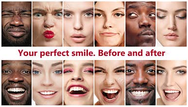 Beautiful close up portraits, concept of teeth treatment