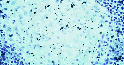 Bacteria or germs microorganism cells under microscope in the color chemical blue fluid
