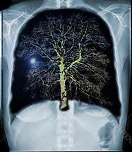 Fresh lungs