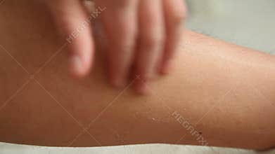 Hairy leg after wax sugar depilation at home.