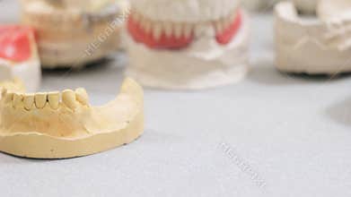 Examination of dentures in the dental laboratory