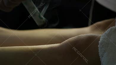 Traditional chinese medicine acupuncture process. Chinese traditional treatment, point heating of the body
