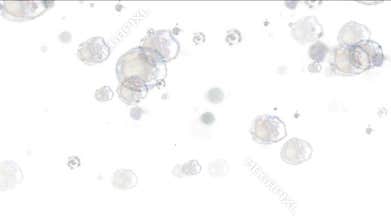 4k Splash bubble blister,underwater drop,soda boiling,gas liquid water drinks.