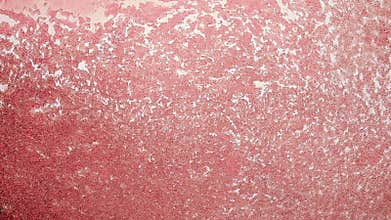 Blood Cell Channel 100x. Blood Platelets seen forming a small pathway at 100x magnification with the aid of a halogen