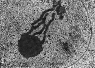 Sex vesicle, TEM