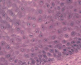 Epidermis. Spinous cell layer