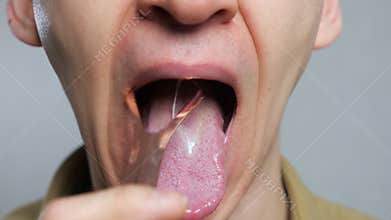 Close-up of a man performing antimicrobial hygiene with a special scraper.