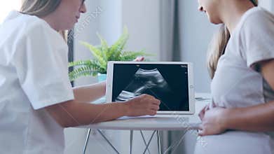 Young woman gynecologist doctor showing to pregnant woman ultrasound scan baby with digital tablet in medical consultatio