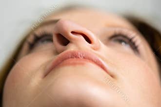 Young Woman Before Aesthetic Facelift