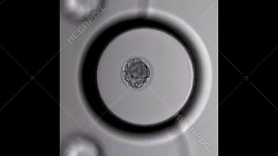 Blastocyst formation human egg fertility cell division under microscope.