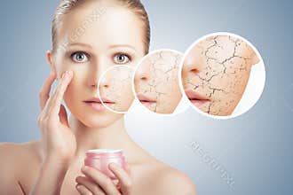 Concept of cosmetic skin care. face of young woman with dry ski